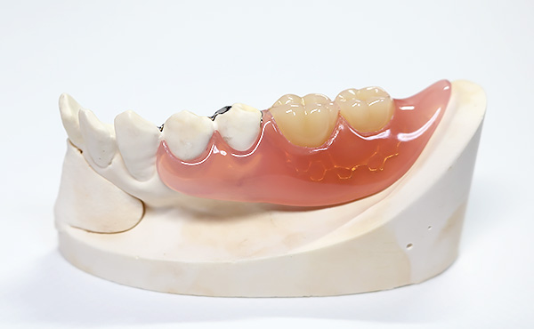 入れ歯イメージ